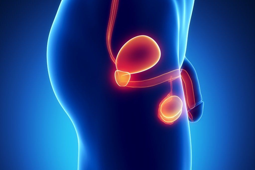 Inflammation de la prostate